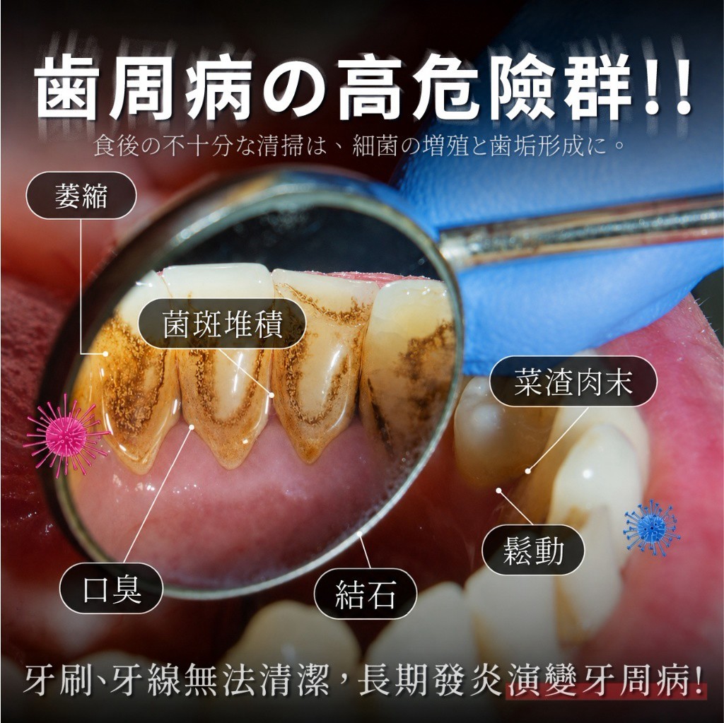 Worma® 便攜式電動沖牙器 — 圖 2